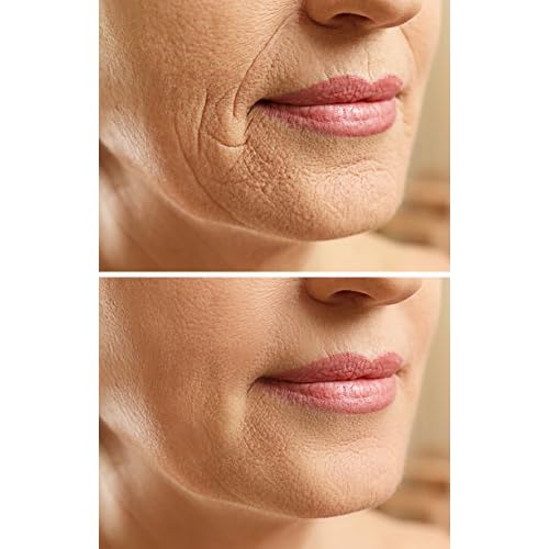 Wrinkle Eraser Night Cream Zion Health 1 oz Cream