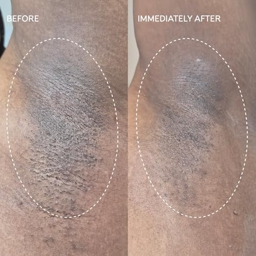 Fur Flash Repair Jelly ? Hypochlorous Acid Aftercare Gel for Post-Wax, Shave, or Laser ? Soothes Redness, Bumps, and Irritation Dermatologist-Tested, Fragrance-Free (2.0 fl oz / 60mL)