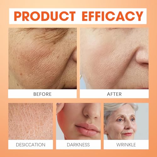 Grass-Fed Beef Tallow and Honey Balm ? Whipped Face Moisturizer for Dry & Sensitive Skin ? Natural Skin Care for Face & Body ? Handcrafted with Raw Honey & Olive Oil ? 1.3 oz
