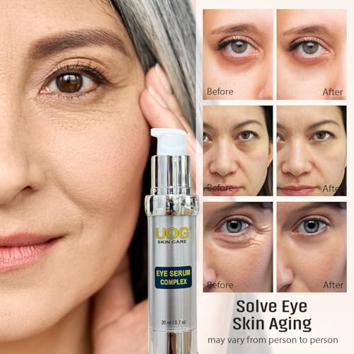 UOG (United One) Eye Serum Complex ? Rapid Reduction Eye Serum for Dark Circles, Puffiness, Wrinkles & Crow¡¯s Feet | Anti-Aging Formula for Firm, Youthful Eyes | Hydrates & Smooths (20ml / 0.7oz)
