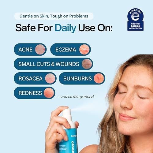 Hypochlorous Acid Spray ? Dermatologist Tested HOCl Facial Cleanser for Sensitive, Acne-Prone & Irritated Skin ? Soothes Redness, Eczema, Rashes & Itching ? Skin Repair Spray, 6.8 oz - Honeydew Labs
