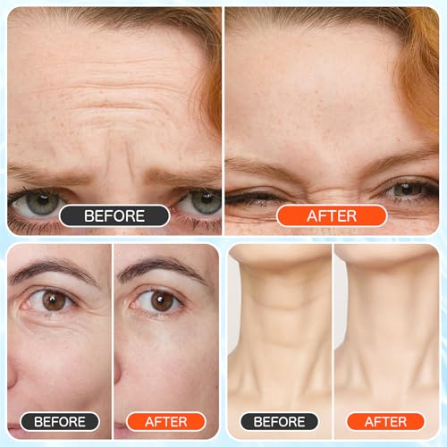Forehead Wrinkle Patches 15 PCS - Smooth Fine Lines & Wrinkles, Anti-Wrinkle Patches with Hydrolyzed Collagen with Aloe, for Wrinkle Removal, Firming, Hydrating Skin Care - New Version 6