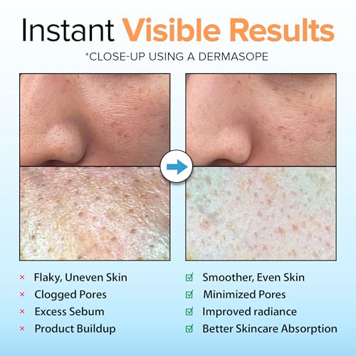 Ebanel Brightening Peeling Gel with Cotton Cellulose, Rice, Papaya, Centella, Hyaluronic Acid for Face and Body, Gentle Exfoliating Face Scrub Gel Peel Wash, Deep Pore Cleanser Minimizer Exfoliator