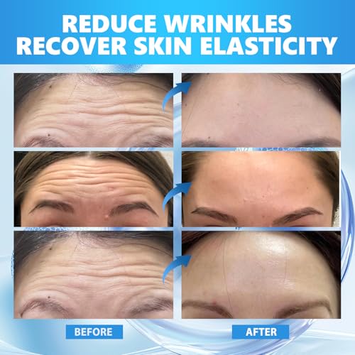Forehead Wrinkle Patches with Collagen and Vitaminer, Bio-fber Facial Patches to Smooth Forehead Wrinkles & Damascus Rosewater Deep Moisturizing Skin