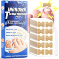Toenail Fungus Treatment Extra Strength, Ingrown Toenail Treatment, 80 Pcs Glue-Free Breathable Corrector Patches, Professional Ingrown Toenail Tools, Not Prone to Falling Off, with File