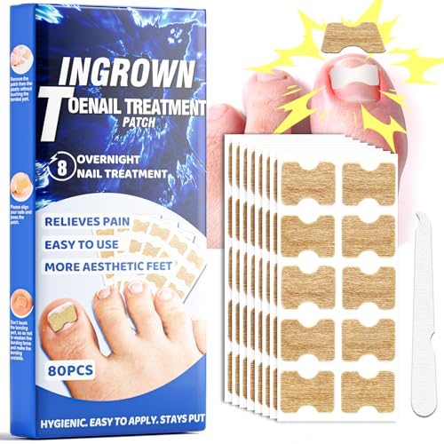 Toenail Fungus Treatment Extra Strength, Ingrown Toenail Treatment, 80 Pcs Glue-Free Breathable Corrector Patches, Professional Ingrown Toenail Tools, Not Prone to Falling Off, with File