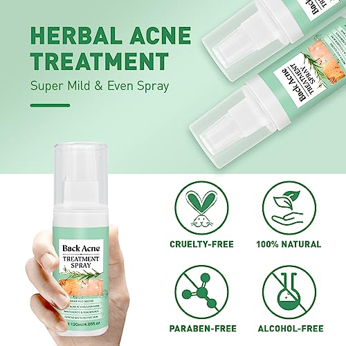 Back Acne Treatment With Herbal Formula, 2% Salicylic Acid & Tea Tree Oil - Body Spray Solution for Acne, 120ml (2PCS)