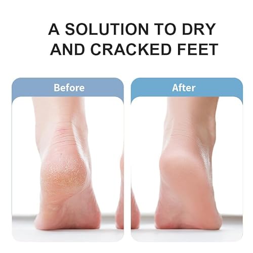 Electric Foot Callus Remover, Rechargeable Pedicure Tool with 3 Quartz Rollers, 3-Speed LED Light, IPX6 Waterproof, Type-C Fast Charge, 4 h Runtime, Cracked Heels & Dead Skin Remover for Women Men