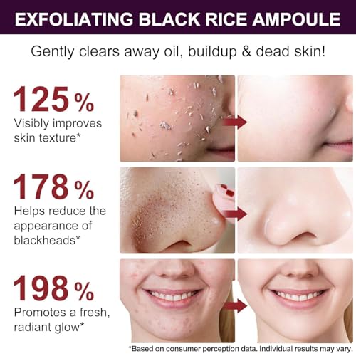 Black Rice Exfoliant, Peel Shot Glow Exfoliating Face Serum, Korean Skin Care Soft Exfoliating Body Scrub Dead Skin Cells, Blackheads Remover For All Skin Types 100ml