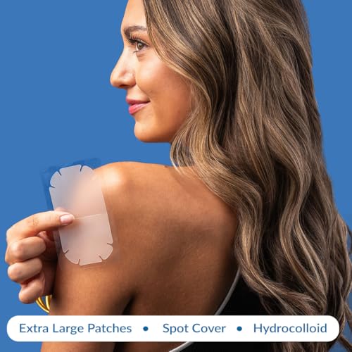 EZACNE¢â Extra Large Pimple Patches for Body ? Large Hydrocolloid Acne Patches for Back, Face, Forehead, Chin, Neck, Shoulders ? Big Zit Patch for Breakouts (5 Count)