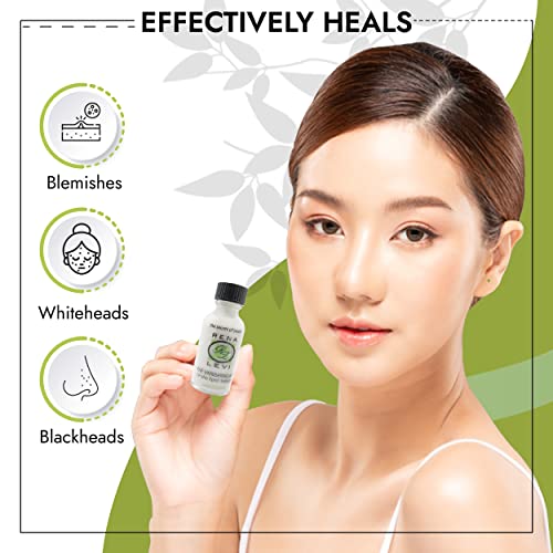 Acne Spot Pimple Drying Lotion - For Face and Body Use, Dries Out Blemishes and Pores - 1oz