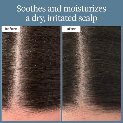 Briogeo Scalp Revival Rosemary Pre-Wash Oil | Moisturizing Scalp Treatment for Dry, Flaky, or Itchy Scalp | Strengthens Hair & Soothes Scalp | Vegan & Cruelty-Free