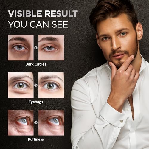 RAZONIX Eye Bags Treatment for Men: Caffeine Eye Roller for Puffy Eyes and Puffiness ? Under Eye Cream for Dark Circles (Medium, Unscented)