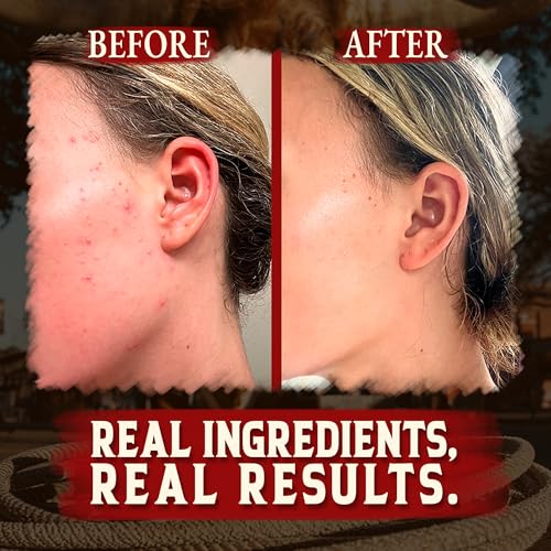 Organic Beef Tallow for Skin - 2OZ (Unscented, Concentrated) ? Grass Fed Beef Tallow for face + Body ? US-Made Tallow and Honey Balm Moisturizer for Dry & Sensitive Skin, Eczema, Rosacea(No Additives)