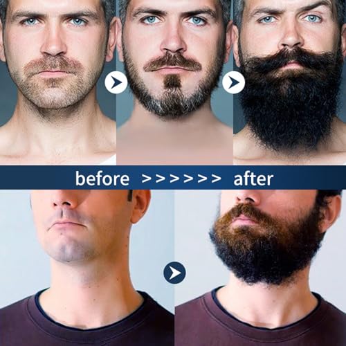 Para Barba, Beard Stimulating Balm Beard Cream, Estimulante Para Barba, B?lsamo Para Crecimiento De Barba Para Hombre, Ultra Potente Apolo Balsamo Negro Thicker, Fuller (1pcs)
