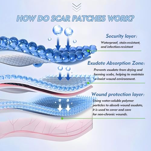 Rayyl Silicone Scar Sheets (1.6" x 60" Roll - 1.5M) - Advanced Silicone Scar Tape Roll Skin-Safe Flexible Strips for Smoother Looking Skin C-Section Recovery Everyday Scars Reusable Value Pack