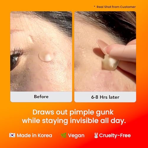 AVARELLE Acne Cover Patch Guardian ? Invisible UPF 50+ Daytime Sun Guard Hydrocolloid Pimple Patches with Cica, Tea Tree & Calendula, Smart Acne Patch for Acne-Prone Skin, 40 Count