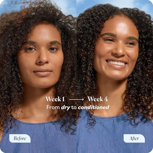 Sky Organics Castor Oil - USDA Certified Organic Hair Oil for Hair Growth, Skin, Face, Eyelashes - Cold Pressed & Hexane Free - Pure Organic Castor Oil Pack Wrap - Carrier & Hair Treatment Oil