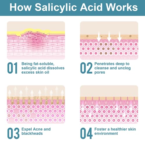 Salicylic Acid Powder (4.58 oz/130 g), Ultra Pure Cosmetic Grade Original Ingredients with no Additives, BHA Exfoliant for DIY Cleanser, Toner, Shampoo, Body Wash, Lotion