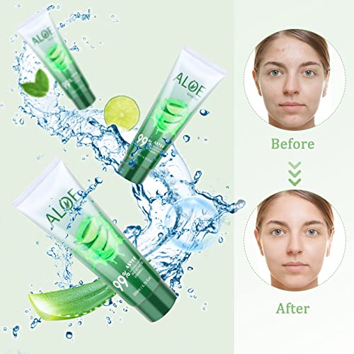 200x2 ML Aloe Vera Gel ? 99% Organic Pure Aloe Vera Hydrating Face & Body Moisturizer, Natural Aloe Cream for Dry Skin, Sunburn, Acne, Soothing & Moisturizing