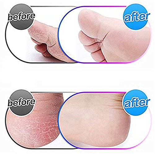 8 Pack Blue Replacement Roller Compatible with Scholl Express Pedi Foot Smoother-Extra Coarse