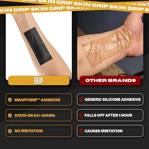 Skin Grip Medical Grade Silicone Scar Tape 1.6"x120" Roll - Increased Strength & Reduced Irritation - Silicone Scar Sheets For Face, Surgical Scars, C-Section, Keloid Treatment, Tummy Tuck, Burn, Acne