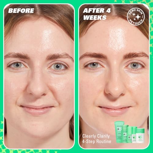 Revolution Skin, Cloud Clear Niacinamide & IPC Clarifying Moisturizer, Lightweight & Hydrating Face Cream, Vegan & Cruelty-Free, 1.69 fl oz