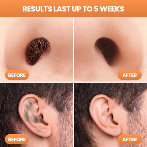 Nose Wax Kit Men With 30 Nose Waxing Sticks, Nose Hair Wax Kit With100g Wax, Up to 20 Uses, Safe, Quick and Painless Nose Hair Removal for Men