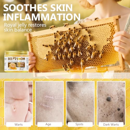 Bee Venom Cream, Natural Bee Venom Skin Treatment Cream-for Removing and Repair, Effective In Reducing Skin Blemishes, Gentle and Non-irritating(Yellow)