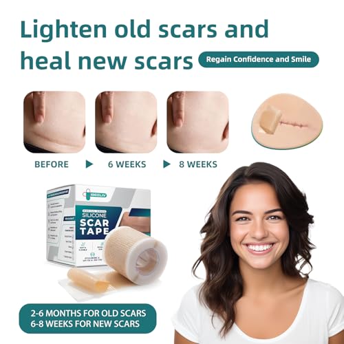 Silicone Scar Gel Sheets: Medical Grade Scar Tape for C Section Surgical Tummy Tuck Keloid Treatment?Scar Removal for Face and Skin