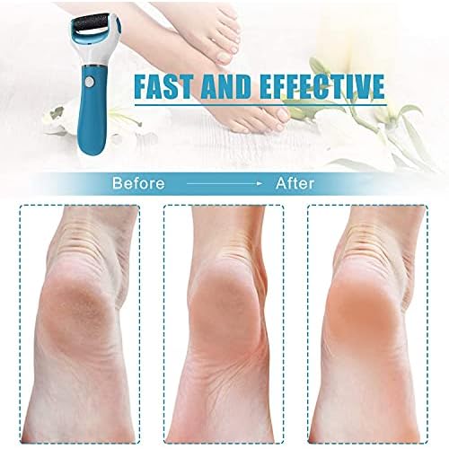 Electric Foot File Callus Remover Professional, 2-Speed Rechargeable Pedicure Tool for Remove Calluses, Dry, Hard, Dead, Cracked Skin, Includes 2 Coarses (Blue)
