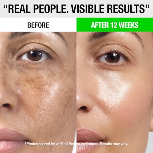 Dark Spot Clarity Oil Serum with Vitamin C for Uneven Tone & Post-Acne Marks ? Korean Vegan Skincare with Ginseng Berry, Licorice Root, Arbutin & Tranexamic Acid by BYRANA ? 1 oz