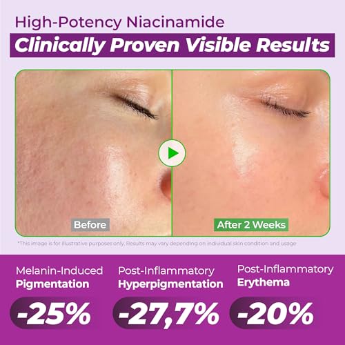 JUMISO Niacinamide 20% Face Serum, Dark Spot & Uneven Tone Care, TXA + Glutathione, Pore & Oil Control for Glass Skin, Centella Soothing, Korean Skincare, 1.35 fl oz 2 Pack