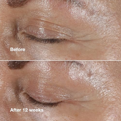 Clinique Smart Clinical Repair Wrinkle Correcting Eye Cream With Hyaluronic Acid + Peptides | Anti-Aging, Hydrating + Depuffing