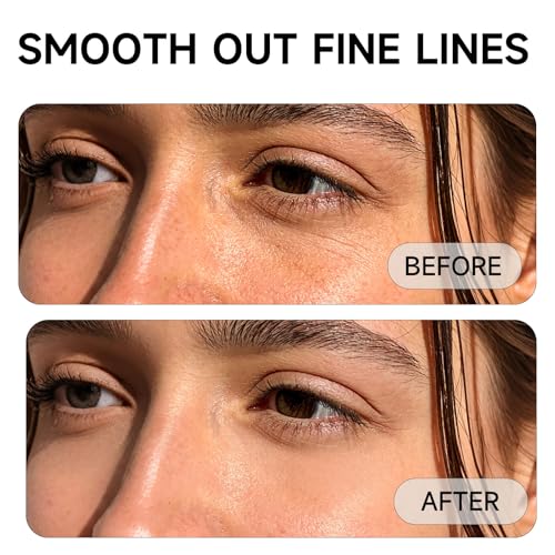 2% BHA Salicylic Acid Liquid Exfoliant Serum For Blackhead Removal,Unclog Pores,Smooths skin118mL 4 fl OZ Face Exfoliator For Facial Skin Care