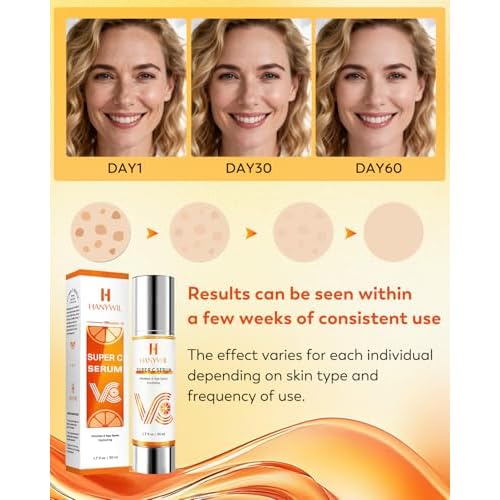 HANYWIL 20% Super Vitamin C Serum for Mature Skin 30-70 Women, Dark Spot Remover with Hyaluronic Acid & Active Lock Tech, Hydrating Total Package Serum for Wrinkles & Firming, Even Skin Tone, 1.7fl oz