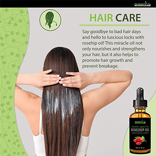 GreenIVe Rosehip Oil Rosa Canina 100% Pure Cold Pressed Virgin Oil Glass Dropper Easy Application (2 Fl Oz)