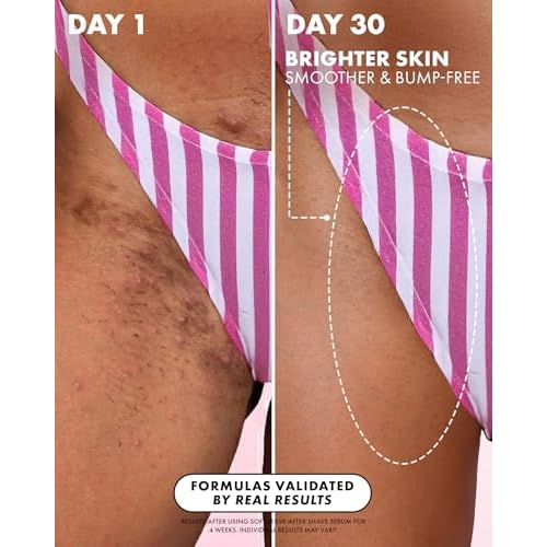 Fur Ingrown Eliminator Serum: Post Hair Removal Care and Ingrown Hair Treatment - 1.1 FL OZ