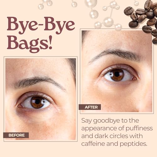 Tree to Tub Caffeine Eye Cream - Hydrating & Firming Under Eye Cream for Dark Circles, Eye Roller for Puffy Eyes, Reduces the Look of Puffiness and Bags, Coffee Eye Cream w/Hyaluronic Acid, Peptides