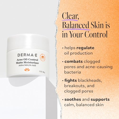 DERMA E Acne Oil Control Face Moisturizer, 2 Oz, Matte Moisturizer with Salicylic Acid, Tea Tree Oil & Aloe Vera, Face Cream Rebalances Sebum Production & Prevents Blemishes, Redness & Breakouts 2 Oz