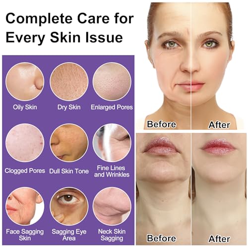 Skin Care Set,6Pcs Professional Womens Teens Tighten Lift Firm Skincare,Hydrate Anti-Aging Facial Routine Kit Travel Gift Set,Birthday Christmas Secret Santa Gifts for Women Teenage Girl Wife Mom | Professional, Travel Skincare, Gift Set