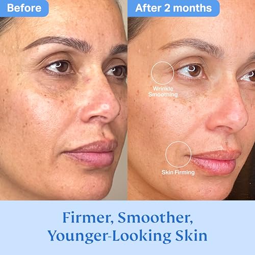 HYDRONOVA Skincare Bundle: Anti-Aging Face & Neck Cream + Total Rewind Sculpting Serum ? Skin-Firming, Wrinkle-Reducing Moisturizer & Line-Smoothing Dark Spot Corrector