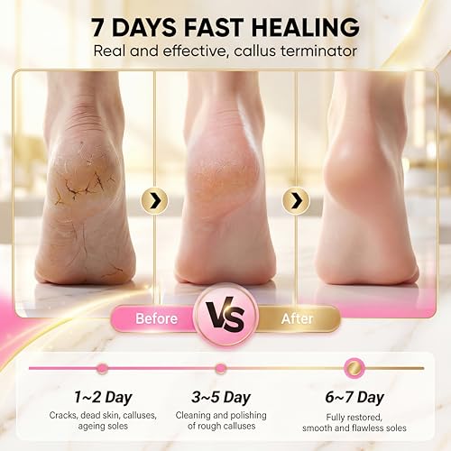 Electric Foot Callus Remover, Rechargeable Pedicure Kit with 10 Heads & 40 Grit Pads, 3 Speed LED Display, Strong Motor for Heels & Dead Skin, Portable & Foldable Callus Remover for Smooth Feet, Pink