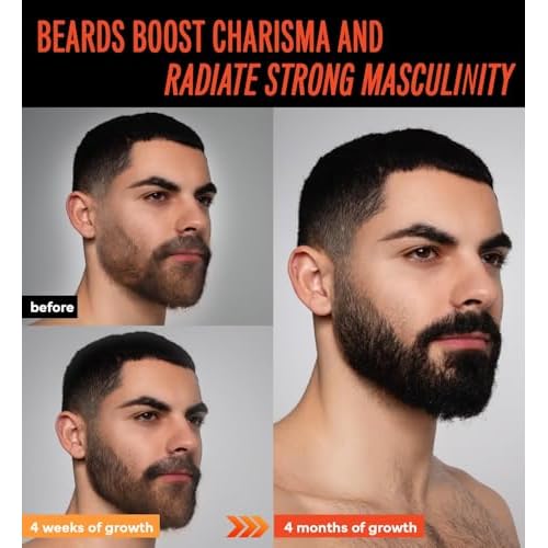 5% Minoxidil Beard Growth Oil for Men: Minoxidil for Men Beard Hair Regrowth Serum with Biotin and Caffeine - Unleash Your Wildness with Stronger Thicker Fuller Beard 2 FL OZ/60mL
