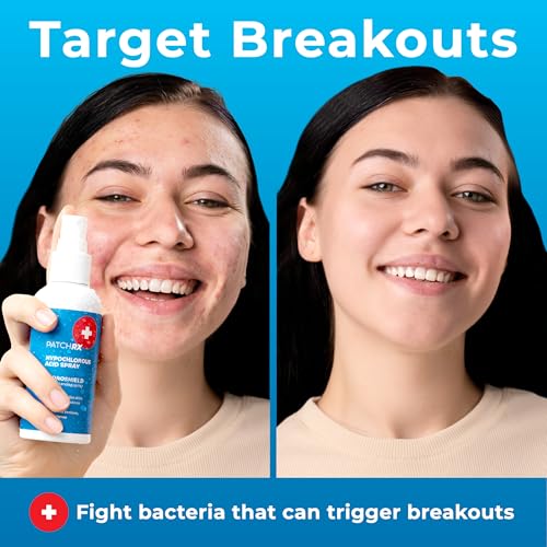Hypochlorous Acid Spray (8oz, 2 packs), HOCL Facial Cleanser Acne Spray for Face, Body, Eczema, Pimples, Breakouts & Overall Skin Recovery (Reduces Redness)