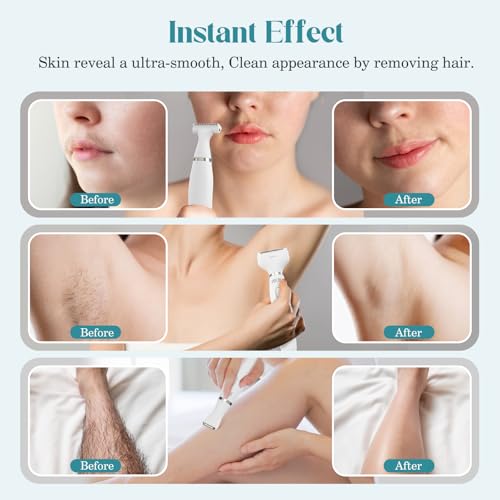 PELCAS Bikini Trimmer for Women Kit 6 in 1 Electric Shaver, Cordless Razors, Nose Hair Trimmer, Shaver for Women & Men Pubic Hair, Private Area, Legs, Face, Nose, Eyebrow, Body Hair Removal