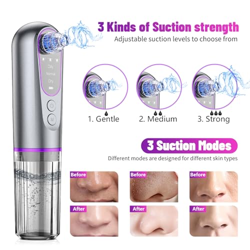 Blackhead Remover Suction Pore Vacuum Hydrating Hydro Facials Pore Cleaner Machine Pimple Extractor with USB Charging Cable Beauty Device