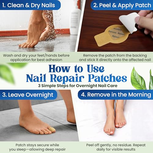 Premium Fungal Nail Patches Toenail Care Extra Fungus Strength 42 Pcs Nighttime Repair Damaged Treatment Discolored Nails 8 Hour Safe Sensitive Skin Easy Apply Women Men gift (42 Count)