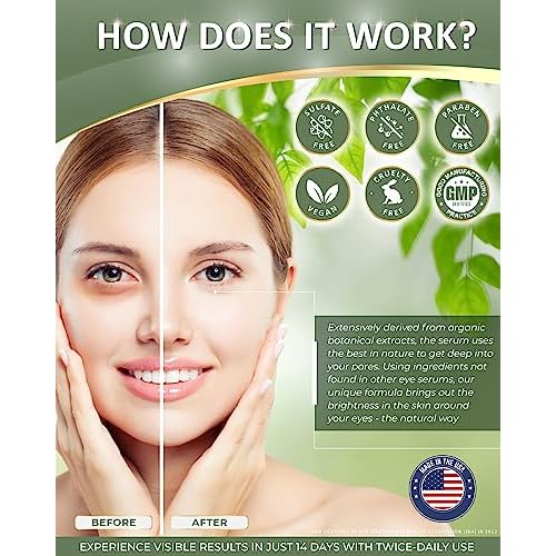 American Natural Eye Serum for Puffy Bags Under Eyes (0.5oz) - Dark Eye Circle Remover with Organic Cucumber & Chamomile Extract | Fine Line & Wrinkle Reduction Anti Aging Serum For Men & Women