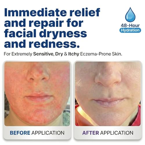 Face Moisturizer #003 ? Hydrating Barrier Repair Face Cream for Dry Sensitive & Eczema Prone Skin ? Fast Absorbing Fragrance Free Non-Greasy Non-Comedogenic Moisturizer ? Made in USA ? 120 g